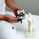 Total Knee Replacement